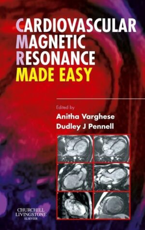 IRM Cardiovasculaire Facile – Anitha Varghese & Dudley J. Pennell